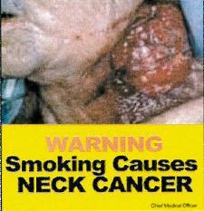 Jamaica 2013 Health Effect mouth - neck cancer, gross, lived experience (front)